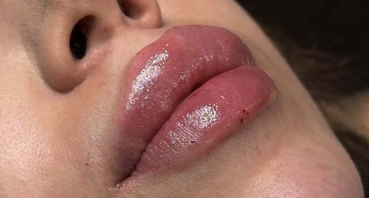 Skin & Sculpt Praxis für Ästhetik Bild 3