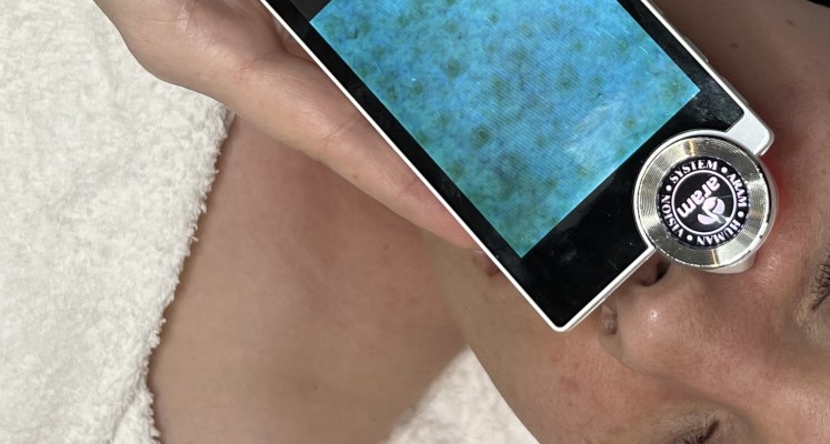 Mileo Skin - Ganzheitliche Hautbehandlungen / Tamara Renner Bild 3