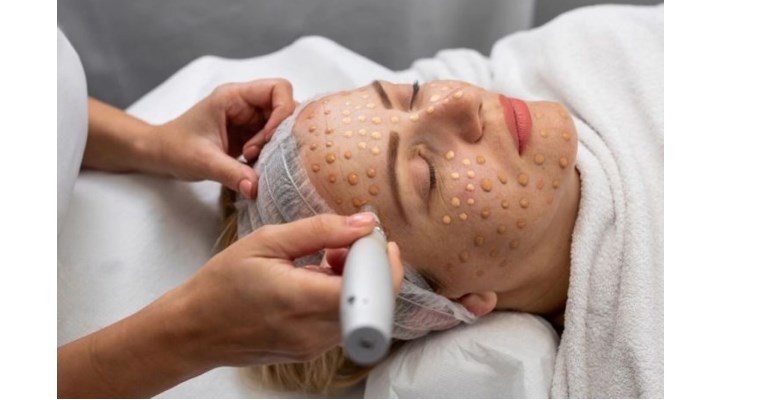 Belle Visage Picture 1