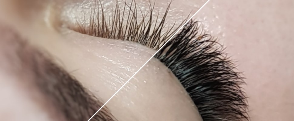 Beautyline