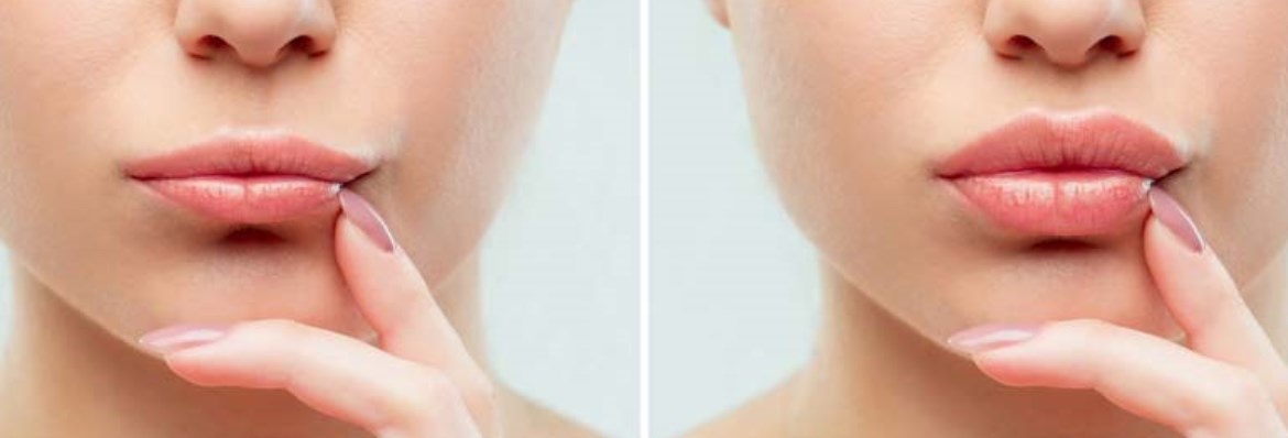 MyBeautyTech